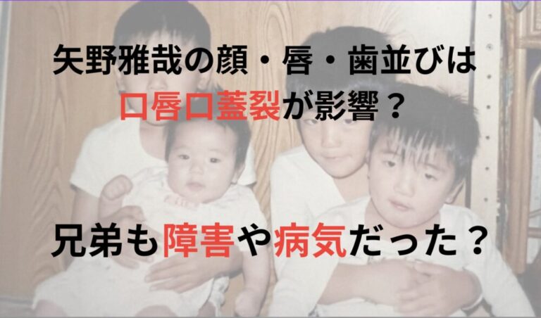 矢野雅哉の顔や歯並びは口唇口蓋裂が影響?兄、弟、妹も障害や病気だった?
